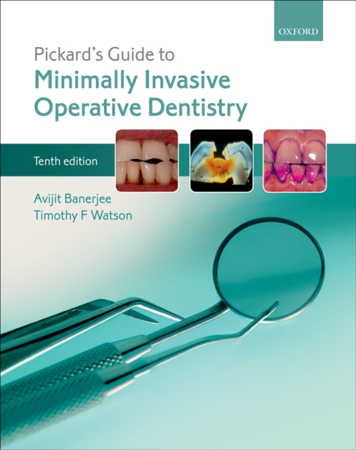 Pickard's Guide to Minimally Invasive Operative Dentistry, PDF eBook