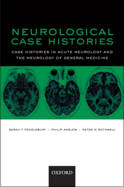 Neurological Case Histories : Case Histories in Acute Neurology and the Neurology of General Medicine, EPUB eBook