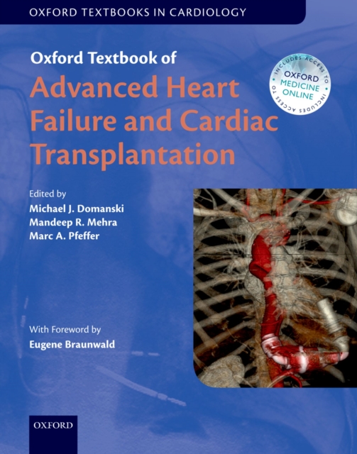 Oxford Textbook of Advanced Heart Failure and Cardiac Transplantation, PDF eBook