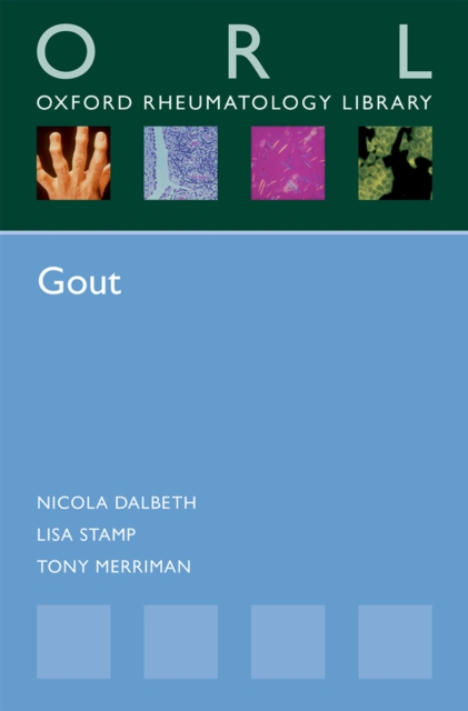 Gout, PDF eBook