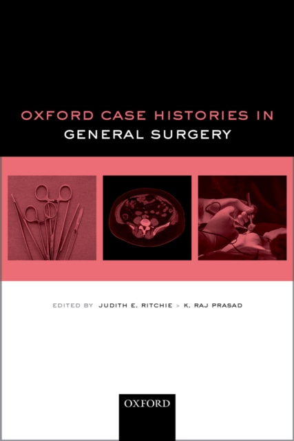 Oxford Case Histories in General Surgery, EPUB eBook