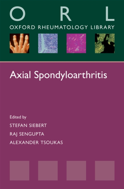 Axial Spondyloarthritis, EPUB eBook