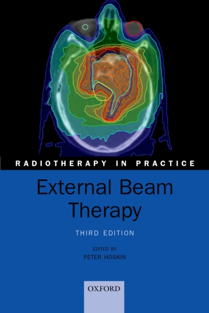 External Beam Therapy, PDF eBook