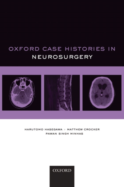 Oxford Case Histories in Neurosurgery, EPUB eBook