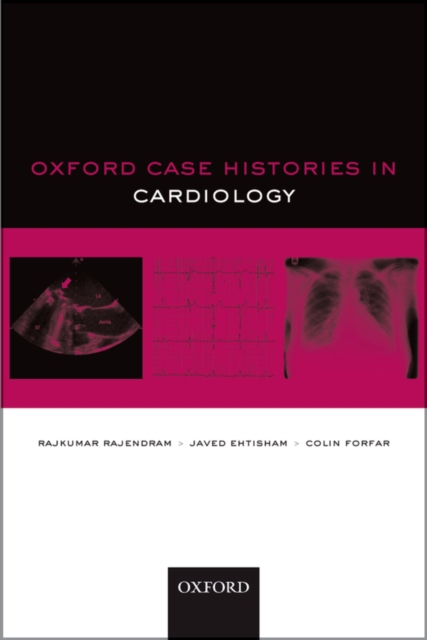 Oxford Case Histories in Cardiology, EPUB eBook