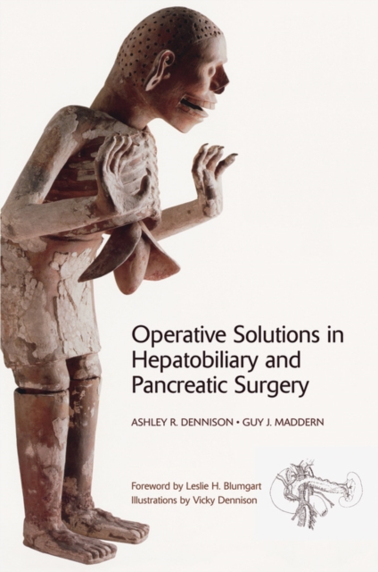 Operative Solutions in Hepatobiliary and Pancreatic Surgery, PDF eBook