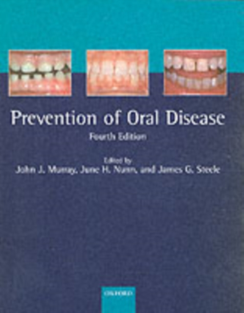 The Prevention of Oral Disease, PDF eBook