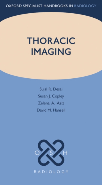 Thoracic Imaging, PDF eBook