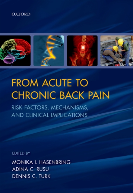 From Acute to Chronic Back Pain : Risk Factors, Mechanisms, and Clinical Implications, PDF eBook