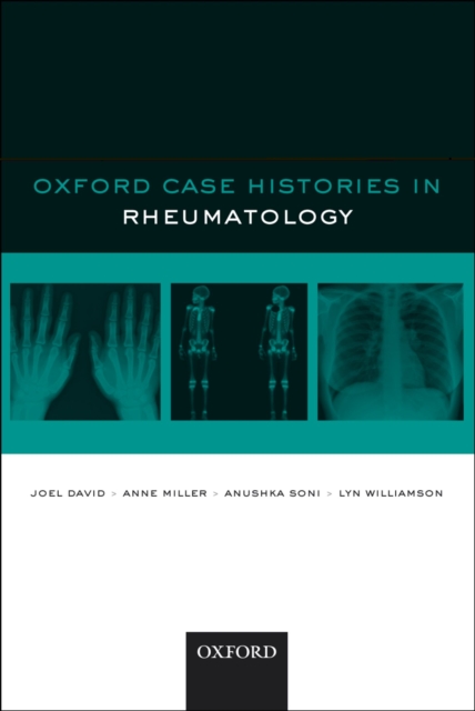 Oxford Case Histories in Rheumatology, EPUB eBook