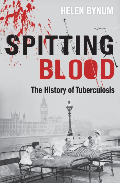 Spitting Blood : The history of tuberculosis, EPUB eBook
