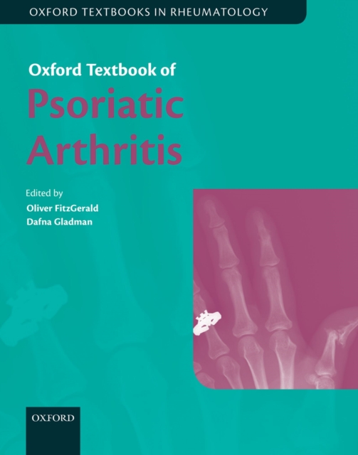 Oxford Textbook of Psoriatic Arthritis, EPUB eBook