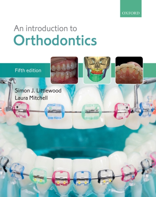 An Introduction to Orthodontics, EPUB eBook