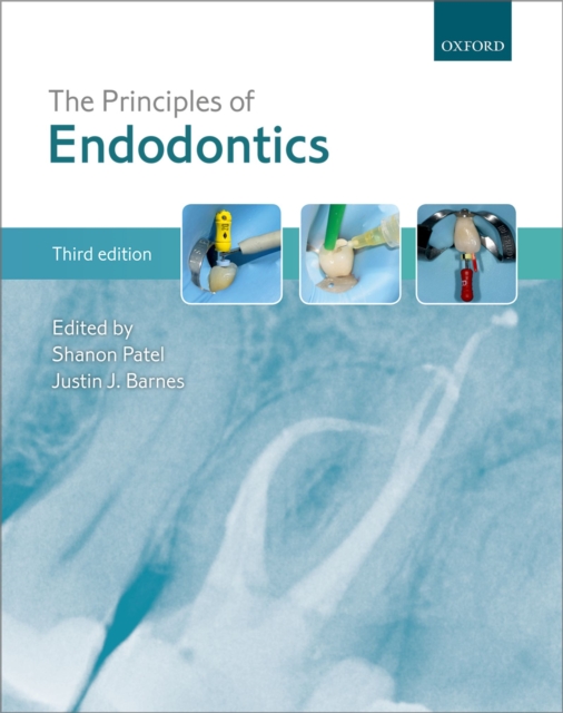 The Principles of Endodontics, PDF eBook
