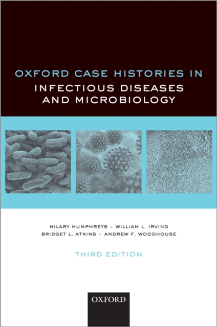 Oxford Case Histories in Infectious Diseases and Microbiology, EPUB eBook