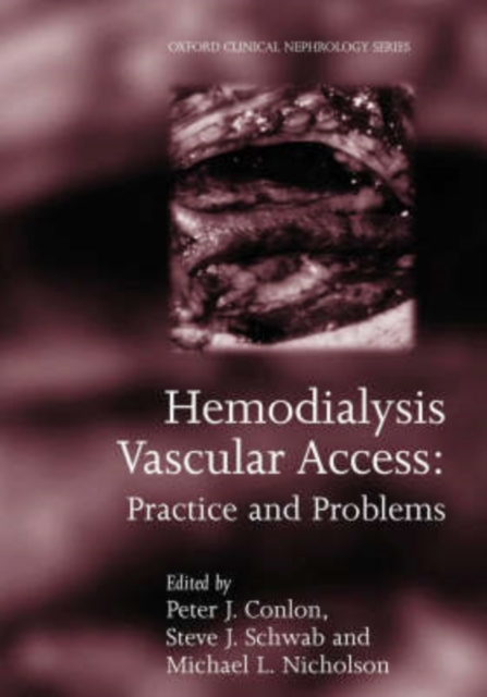 Hemodialysis Vascular Access : Practice and problems, Hardback Book