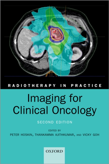 Imaging for Clinical Oncology, PDF eBook