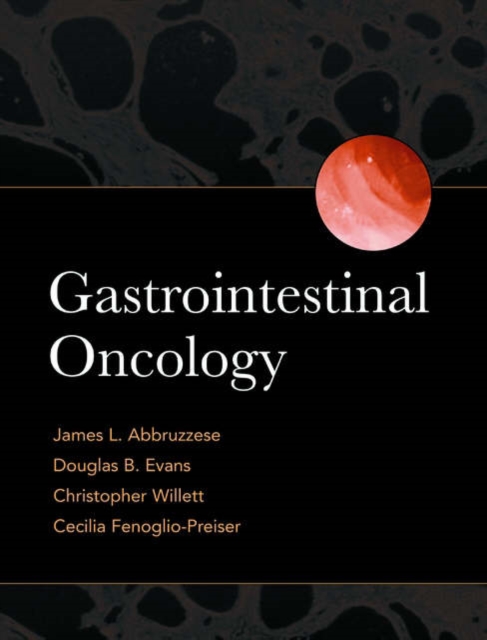 Gastrointestinal Oncology, Hardback Book