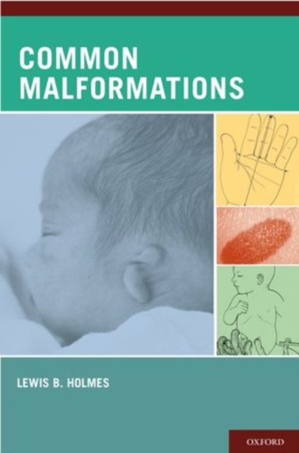 Common Malformations, Hardback Book