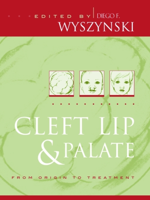 Cleft Lip and Palate : From Origin to Treatment, Hardback Book