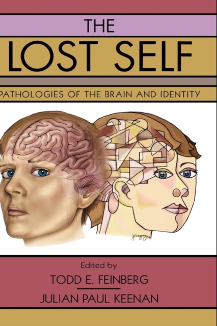 The Lost Self : Pathologies of the Brain and Identity, Hardback Book