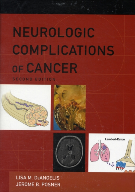 Neurologic Complications of Cancer, Hardback Book