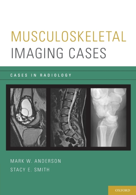 Musculoskeletal Imaging Cases, Paperback / softback Book