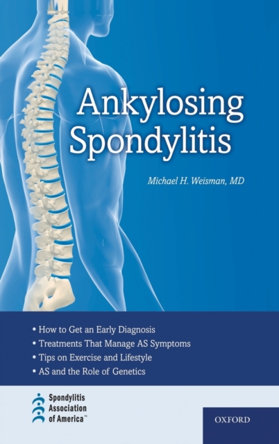 Ankylosing Spondylitis, Hardback Book