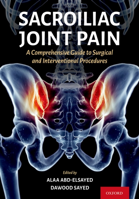 Sacroiliac Joint Pain : A Comprehensive Guide to Interventional and Surgical Procedures, EPUB eBook