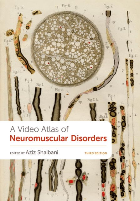 A Video Atlas of Neuromuscular Disorders, PDF eBook