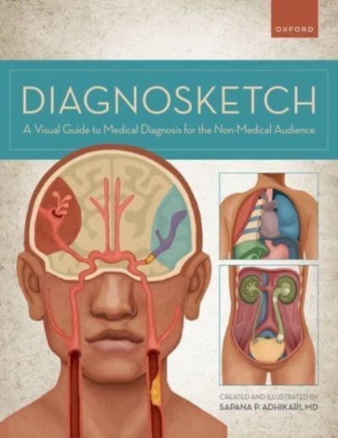 Diagnosketch : A Visual Guide to Medical Diagnosis for the Non-Medical Audience, Spiral bound Book