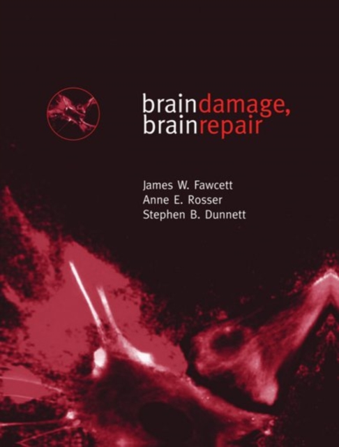 Brain Damage, Brain Repair, Paperback / softback Book