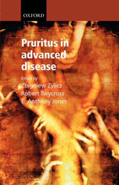 Pruritus in Advanced Disease, Paperback / softback Book
