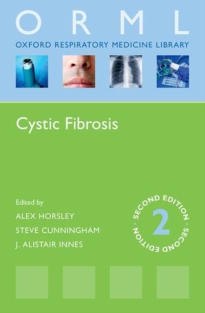 Cystic Fibrosis, Paperback / softback Book