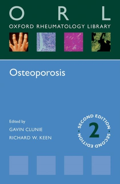 Osteoporosis, Paperback / softback Book