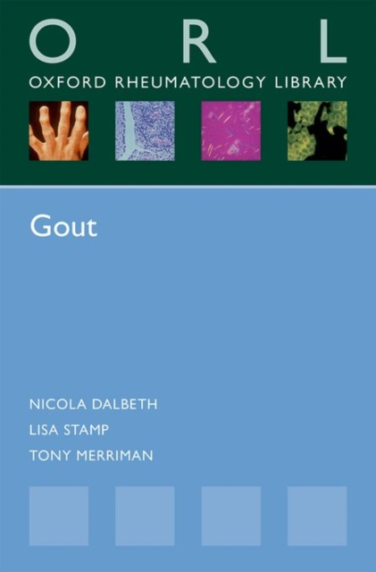 Gout, Paperback / softback Book