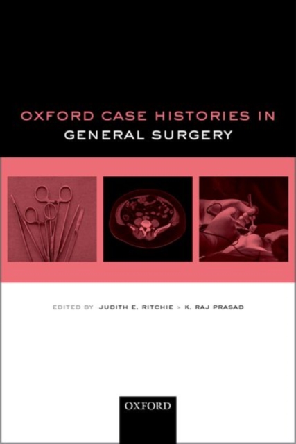 Oxford Case Histories in General Surgery, Paperback / softback Book
