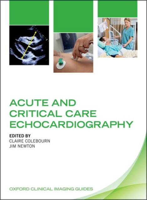 Acute and Critical Care Echocardiography, Paperback / softback Book