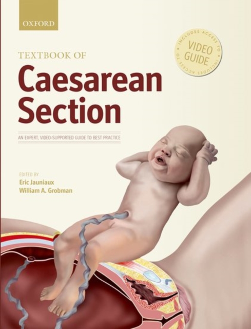 Textbook of Caesarean Section, Hardback Book