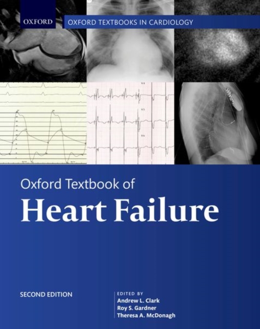 Oxford Textbook of Heart Failure, Hardback Book