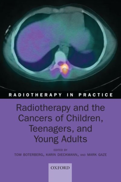 Radiotherapy and the Cancers of Children, Teenagers, and Young Adults, Paperback / softback Book