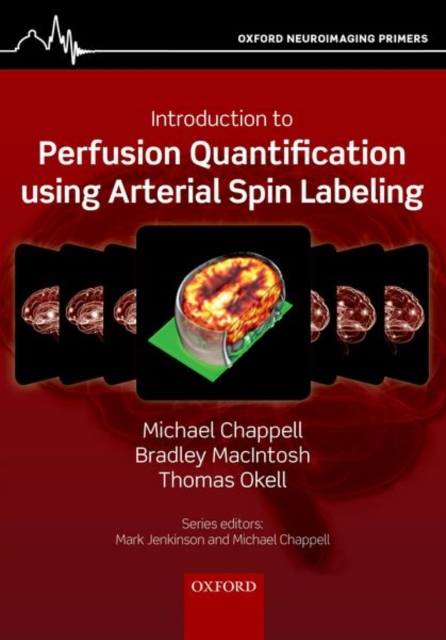 Introduction to Perfusion Quantification using Arterial Spin Labelling, Paperback / softback Book