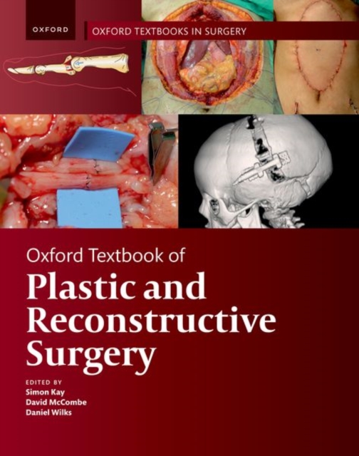 Oxford Textbook of Plastic and Reconstructive Surgery, Paperback / softback Book