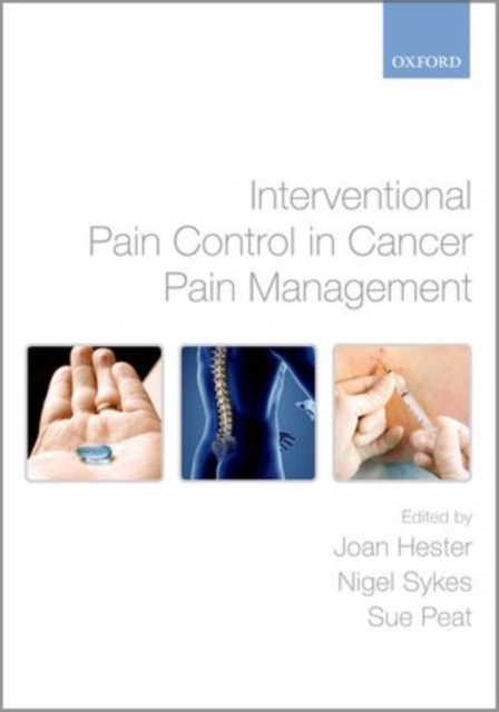 Interventional Pain Control in Cancer Pain Management, Hardback Book