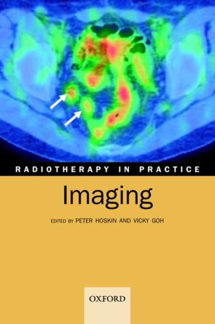 Radiotherapy in Practice - Imaging, Paperback / softback Book