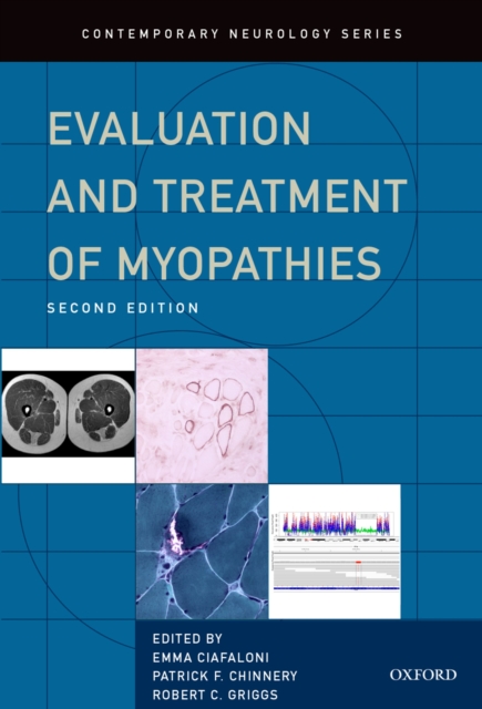 Evaluation and Treatment of Myopathies, EPUB eBook