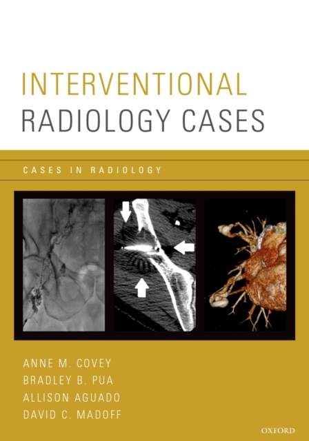 Interventional Radiology Cases, PDF eBook