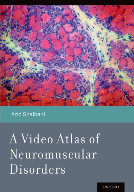 A Video Atlas of Neuromuscular Disorders, PDF eBook