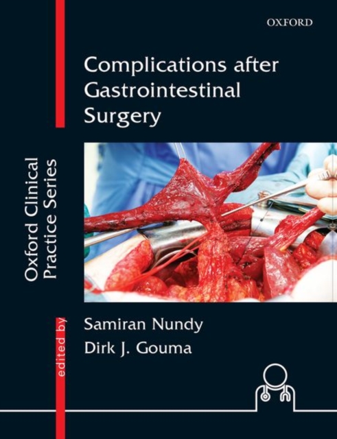 Complications after Gastrointestinal Surgery, Hardback Book