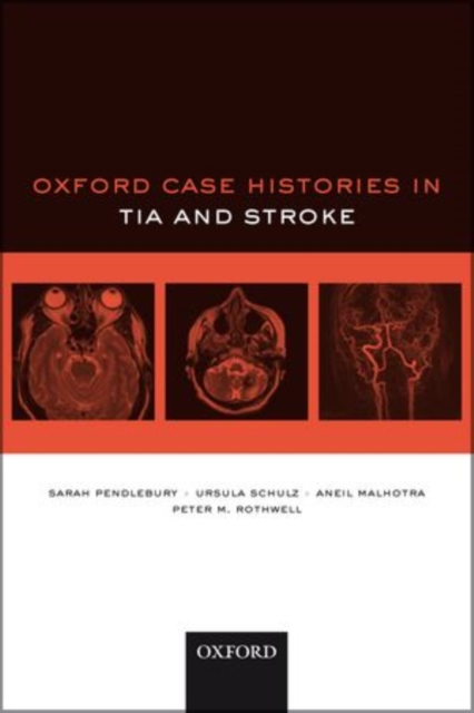 Oxford Case Histories in TIA and Stroke, Paperback / softback Book